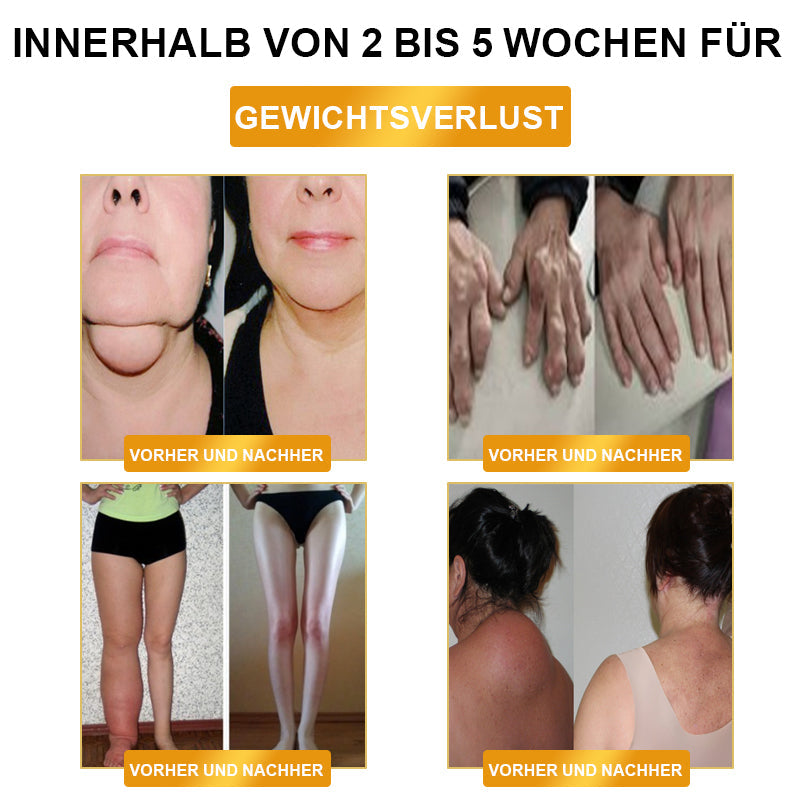 🪆🦩Futusly™ Ultraschall Fettvernichtend & Ferninfrarot Blutzuckerbalancierendes Detox-Armband