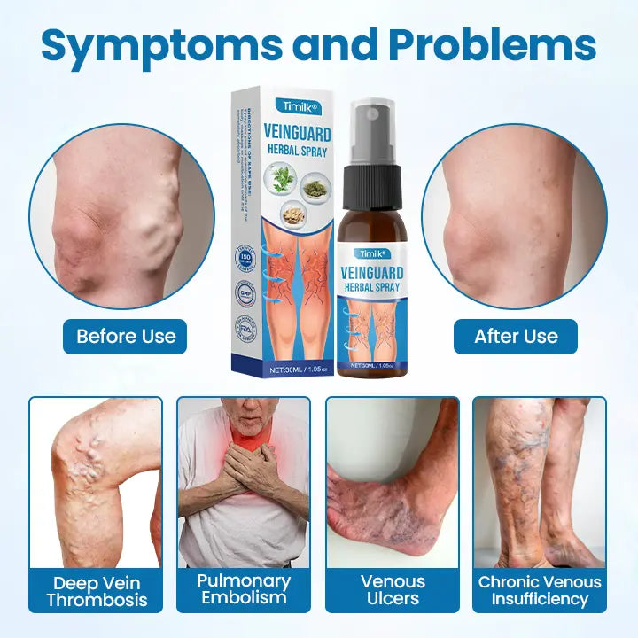 -Timilk® VeinGuard Herbal Spray